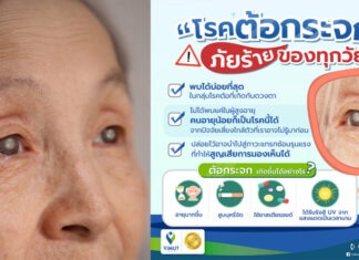 มองไม่ชัด ตาขุ่นมัว เสี่ยง “โรคต้อกระจก”